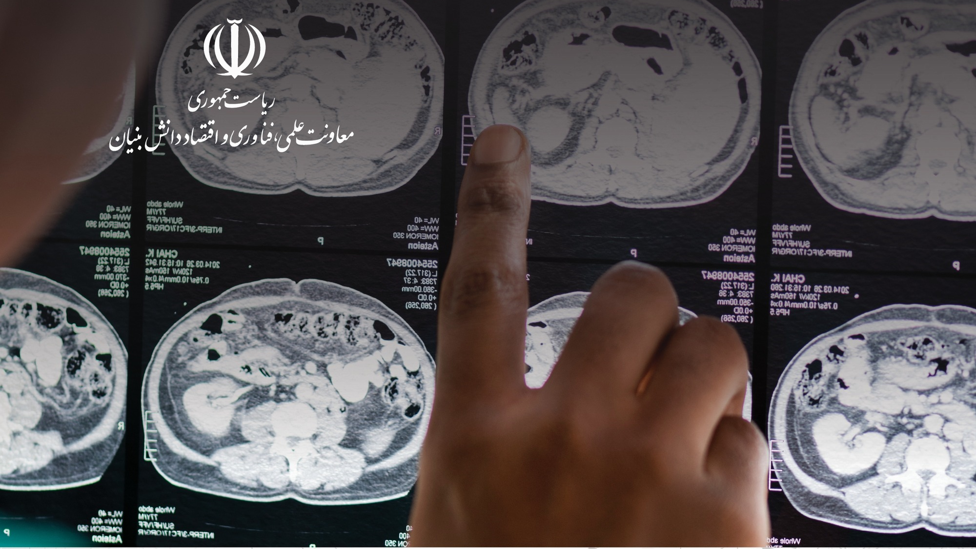 بیماری‌های مغزی