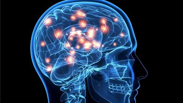 تحریک عمقی مغز