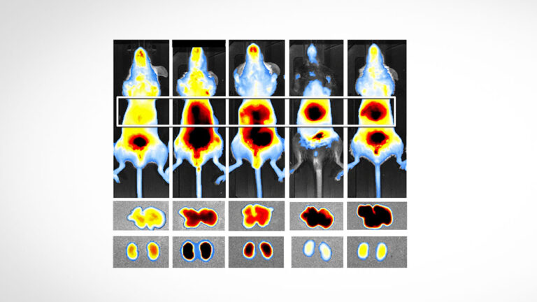 چشم دیجیتال