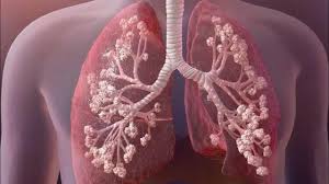 مهندسی معکوس