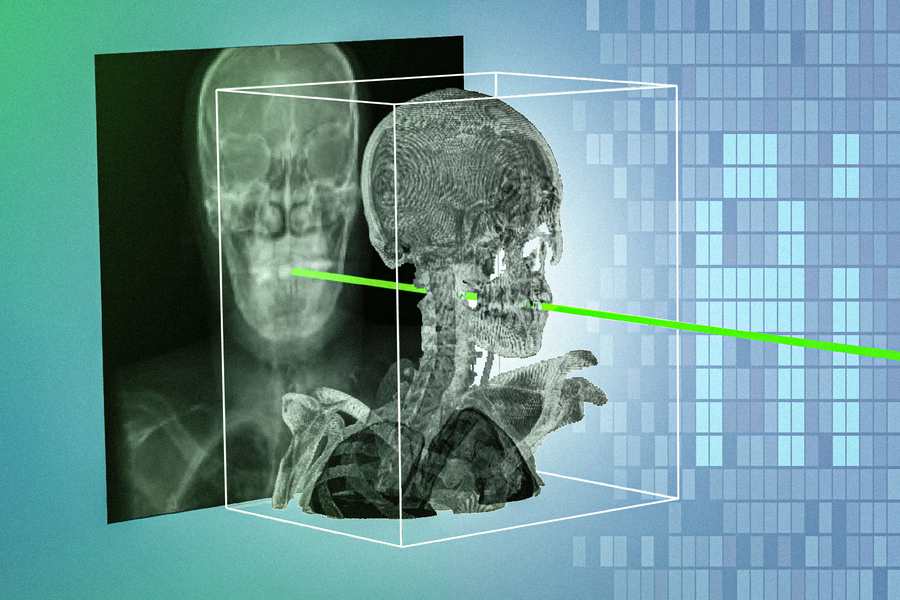 هوش مصنوعی MIT تصاویر X-Ray را به نقشه سه‌بعدی جراحی تبدیل می‌کند